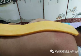 蜡疗中医特色外调疗法——调理腰酸腿痛