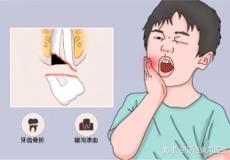 [儿童新牙齿撞松了]一不小心牙齿受伤，松动了怎么办？