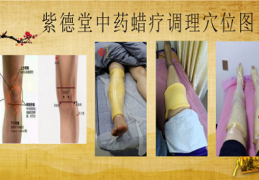 蜡疗为什么能治疗风湿性关节炎