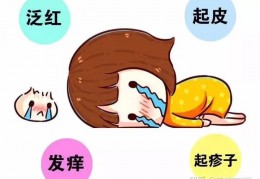 科普｜皮肤过敏期间需要忌口的那些食物