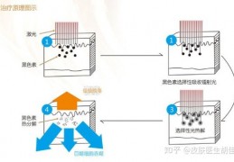 [纹身可以保持多久不褪红]纹身能彻底洗掉吗？