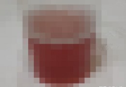 说说我自己尿路感染是怎么治愈的！