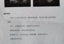 [前列腺长小泡多久合适同房]本人真实前列腺炎治愈方法