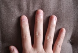 长期抠指甲咬指甲，甲型变得非常短丑，终于去做美甲修正甲型，记录一下